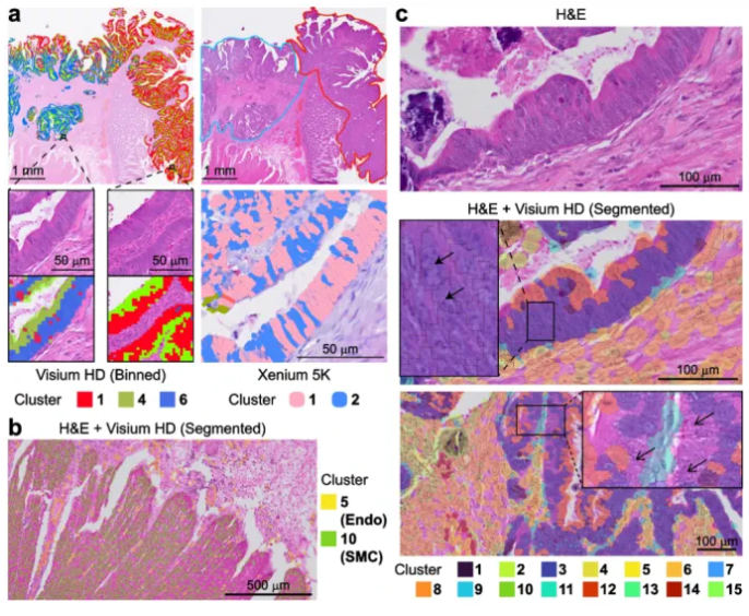 干货预警！Xenium和Visium HD全方位技术对比：优劣&适用场景一次说透